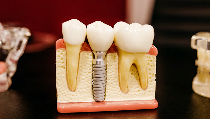 口腔護(hù)理,半年報(bào)